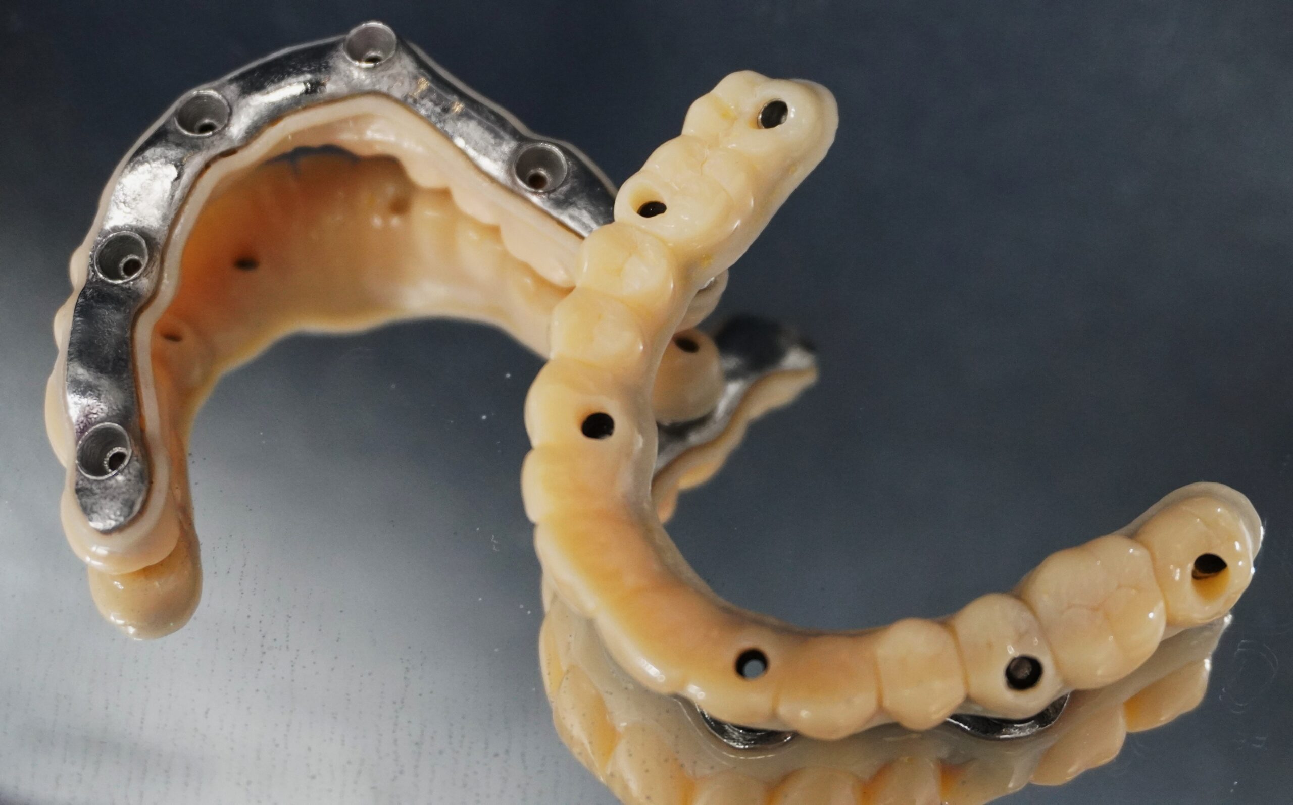 Fixed Teeth Case Study 5