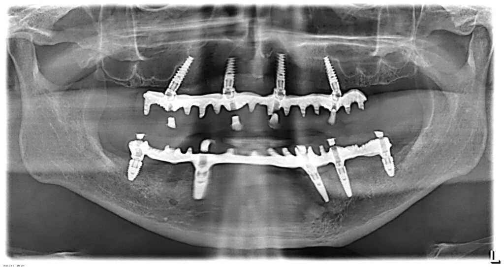 All on Four X-Ray Scan