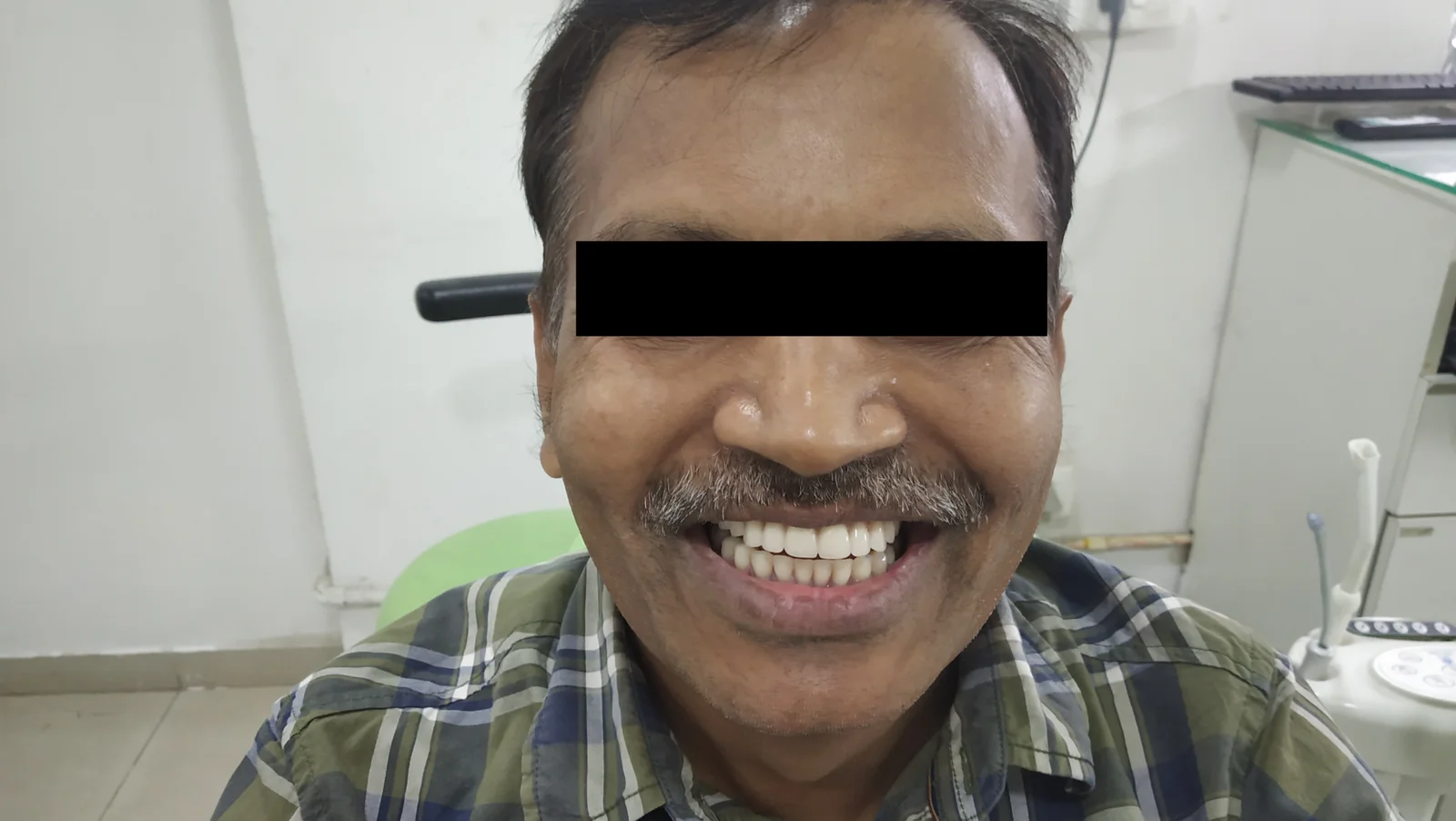 Zygomatic Case Study 1