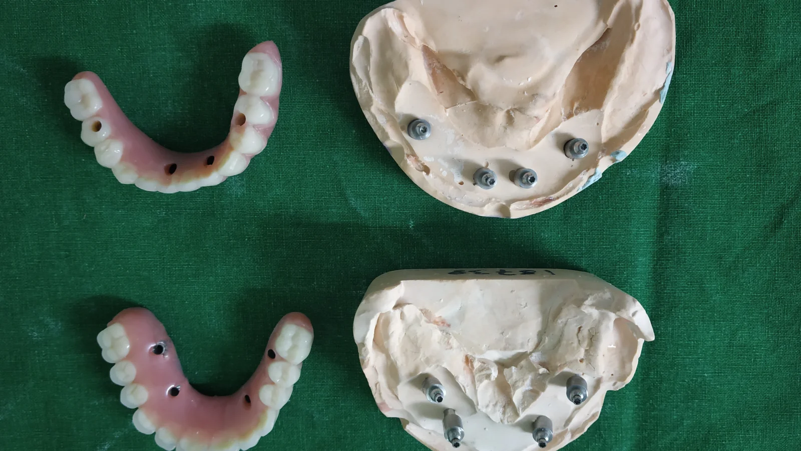 Zygomatic Case Study 2