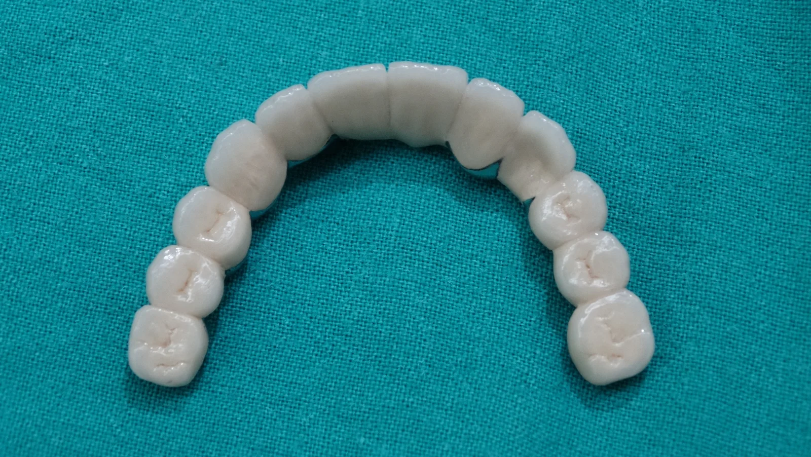 Fixed Teeth Case Study 3