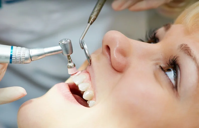 Teeth Cleaning and Polishing